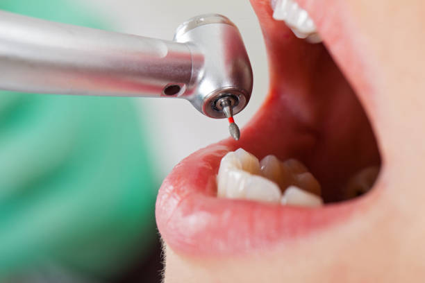 Best Emergency Treatment for Oral Infections in River Falls, WI